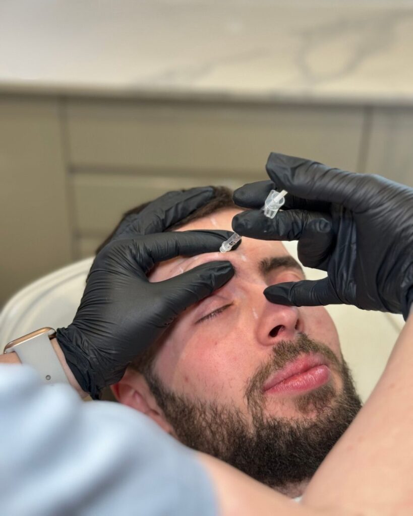 botox procedure 45